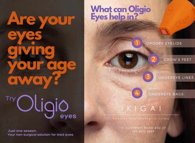 Ikigai Promo